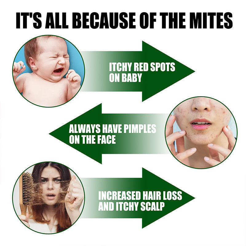 🌹 ⚡Offre limitée : achetez-en 2, obtenez-en 1 gratuitement⚡-🧑‍⚕️Spray puissant anti-acariens