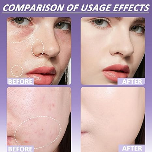 💗DERNIER JOUR - ACHETEZ 1, OBTENEZ 1 GRATUIT💗Correcteur matifiant pour le visage et le corps