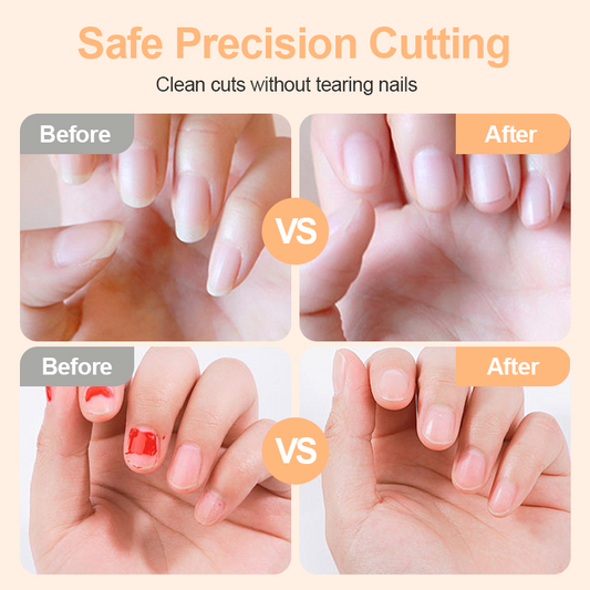 ⏳Spécial à durée limitée⏰Coupe-ongles électrique avec lampe💅