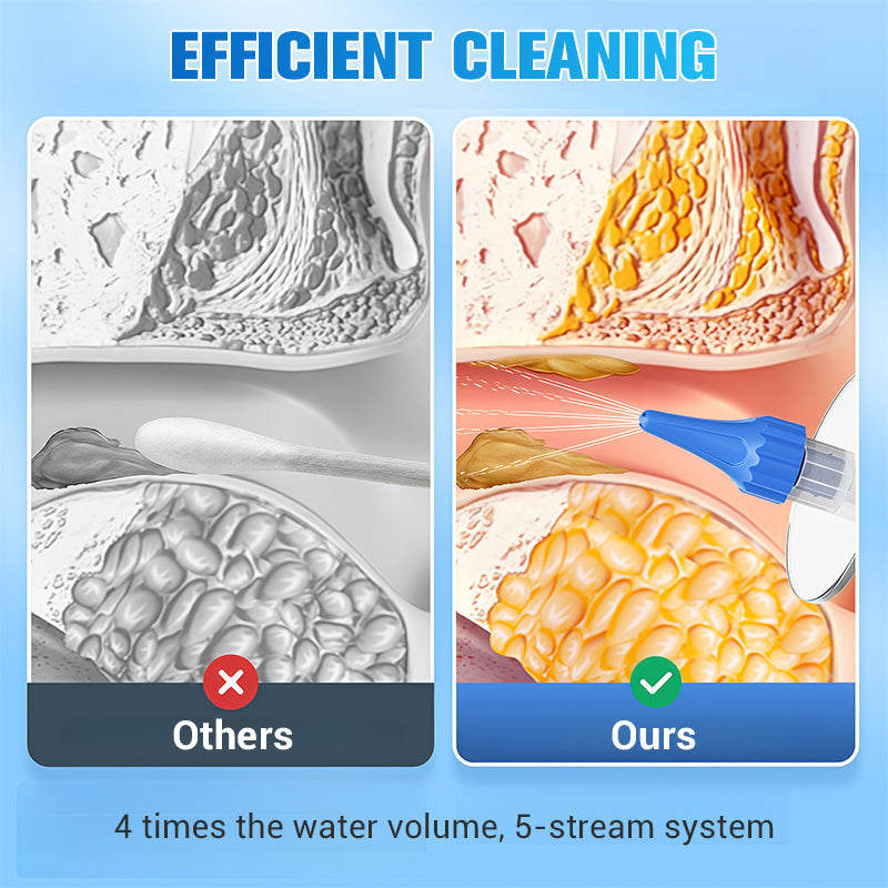 💎 50% DE RÉDUCTION ! 💎 Système Manuel d’Irrigation Auriculaire – Nettoyage en Douceur, 5 Jets & Embouts Sécurisés 🧼👂
